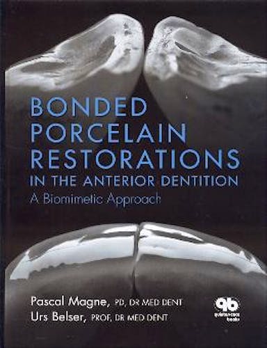 Portada del libro 9780867154221 Bonded Porcelain Restorations in the Anterior Dentition. A Biomimetic Approach