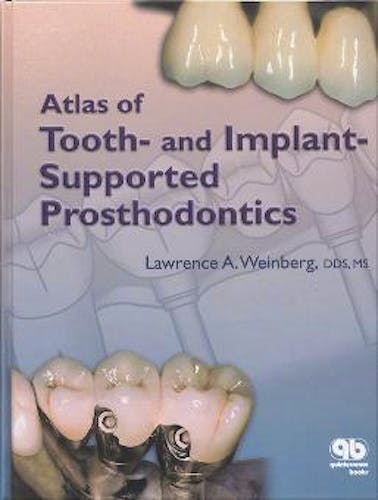 Portada del libro 9780867154276 Atlas of Tooth and Implant-Supported Prosthodontics