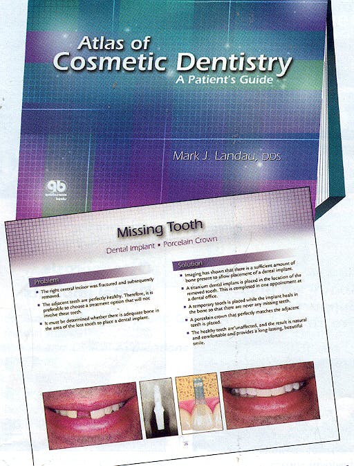 Portada del libro 9780867154283 Atlas of Cosmetic Dentistry