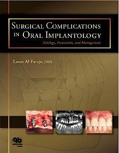 Portada del libro 9780867155068 Surgical Complications in Oral Implantology