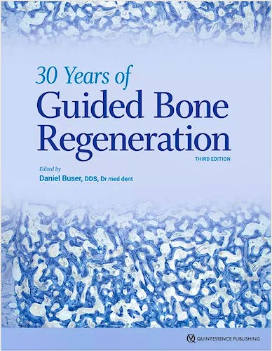Portada del libro 9780867158038 30 Years of Guided Bone Regeneration