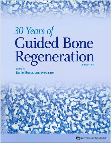 Portada del libro 9780867158038 30 Years of Guided Bone Regeneration