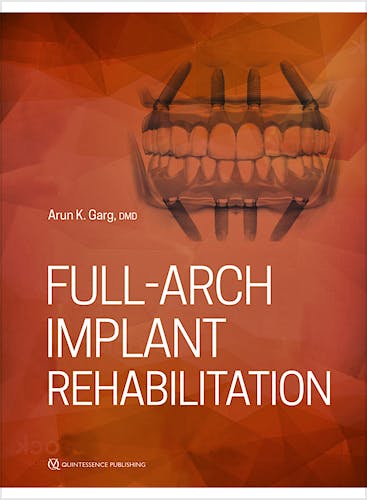 Portada del libro 9780867158090 Full-Arch Implant Rehabilitation