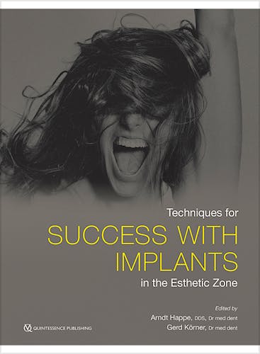 Portada del libro 9780867158229 Techniques for Success with Implants in the Esthetic Zone