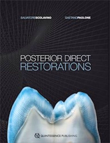 Portada del libro 9780867158236 Posterior Direct Restorations
