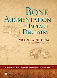 Portada del libro 9780867158250 Bone Augmentation in Implant Dentistry. A Step-by-Step Guide to Predictable Alveolar Ridge and Sinus Grafting