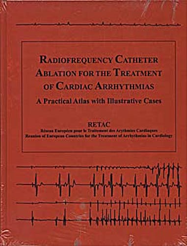 Portada del libro 9780879937102 Radiofrequency Catheter Ablation for the Treatmentof Cardiac Arrhythmias