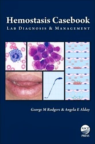 Portada del libro 9780891896173 Hemostasis Casebook. Lab Diagnosis & Management