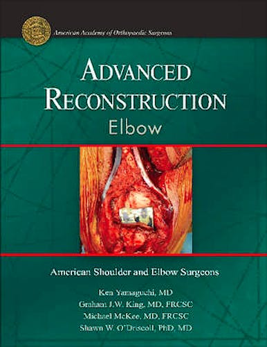 Portada del libro 9780892033911 Advanced Reconstruction Elbow
