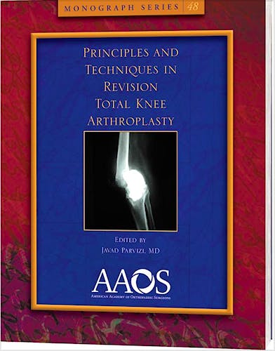 Portada del libro 9780892038428 Principles and Techniques in Revision Total Knee Arthroplasty (Monograph Series 48)