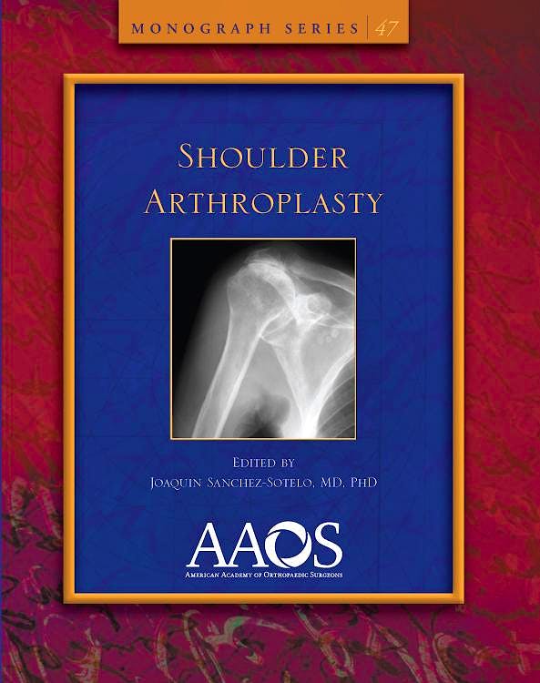 Portada del libro 9780892038565 Shoulder Arthroplasty