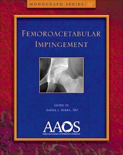 Portada del libro 9780892039722 Femoroacetabular Impingement