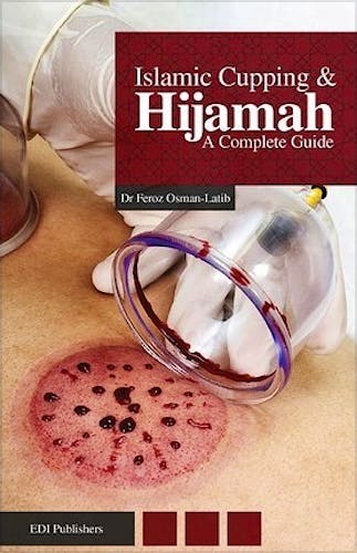 Portada del libro 9780991145508 Islamic Cupping and Hijamah. A Complete Guide