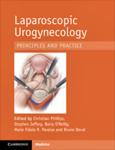 Laparoscopic Urogynaecology. Principles and Practice