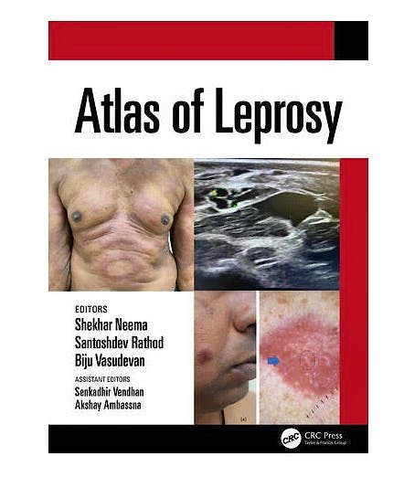 Portada del libro 9781032209241 Atlas of Leprosy