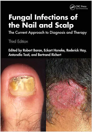 Portada del libro 9781032464305 Fungal Infections of the Nail and Scalp. The Current Approach to Diagnosis and Therapy