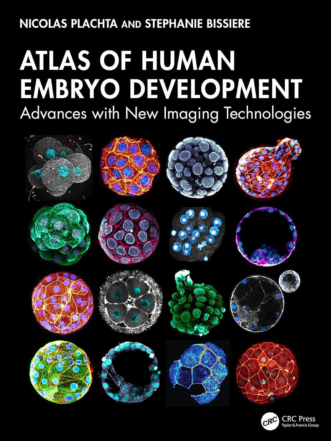 Atlas of Human Embryo Development. Advances with New Imaging