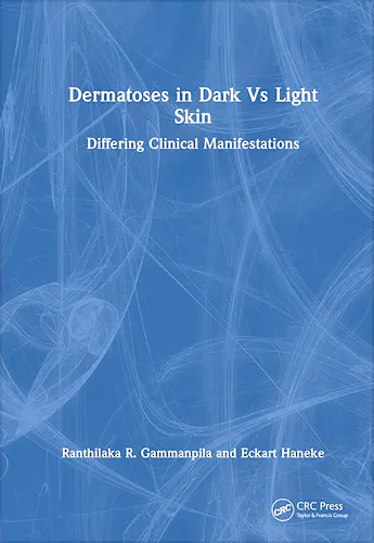 Portada del libro 9781032766638 Dermatoses in Dark Vs Light Skin: Differing Clinical Manifestations