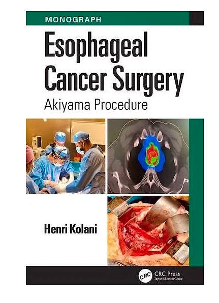 Esophageal Cancer Surgery. AKIYAMA Procedure