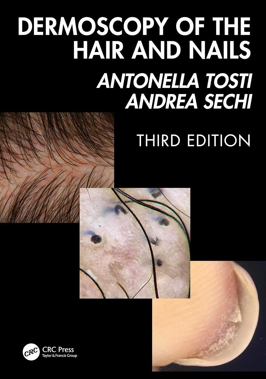 Portada del libro 9781041020028 Dermoscopy of the Hair and Nails