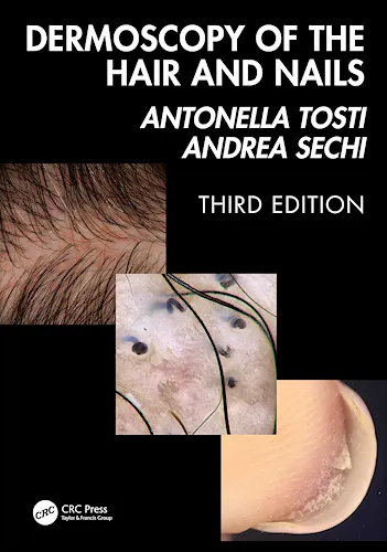 Portada del libro 9781041020028 Dermoscopy of the Hair and Nails