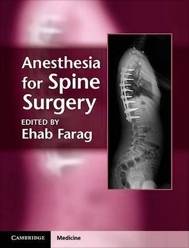 Portada del libro 9781107005310 Anesthesia for Spine Surgery