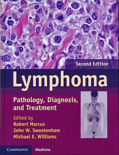 Portada del libro 9781107010598 Lymphoma. Pathology, Diagnosis and Treatment
