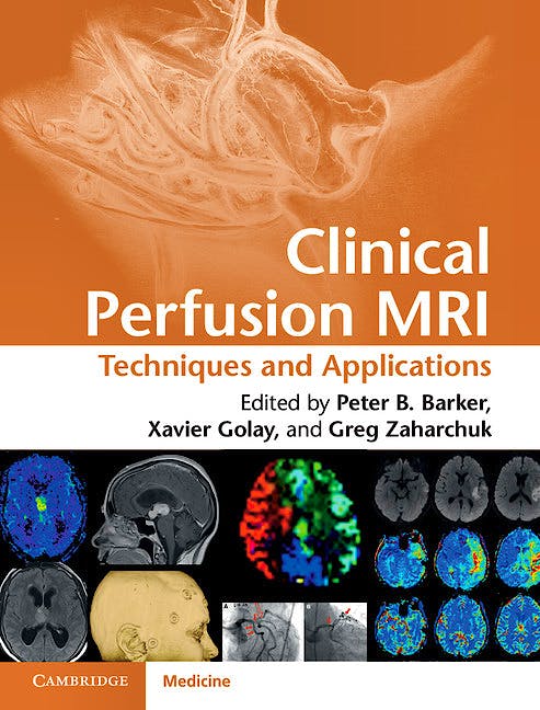 Portada del libro 9781107013391 Clinical Perfusion Mri. Techniques and Applications