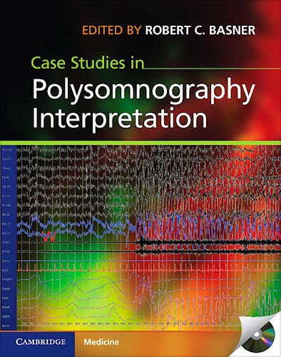 Portada del libro 9781107015395 Case Studies in Polysomnography Interpretation + Cd