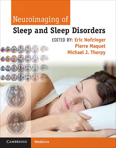 Portada del libro 9781107018631 Neuroimaging of Sleep and Sleep Disorders