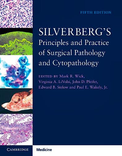 Portada del libro 9781107022836 Silverberg's Principles and Practice of Surgical Pathology and Cytopathology, 4 Vols. + Online Access