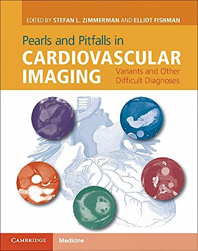 Portada del libro 9781107023727 Pearls and Pitfalls in Cardiovascular Imaging. Variants and Other Difficult Diagnoses
