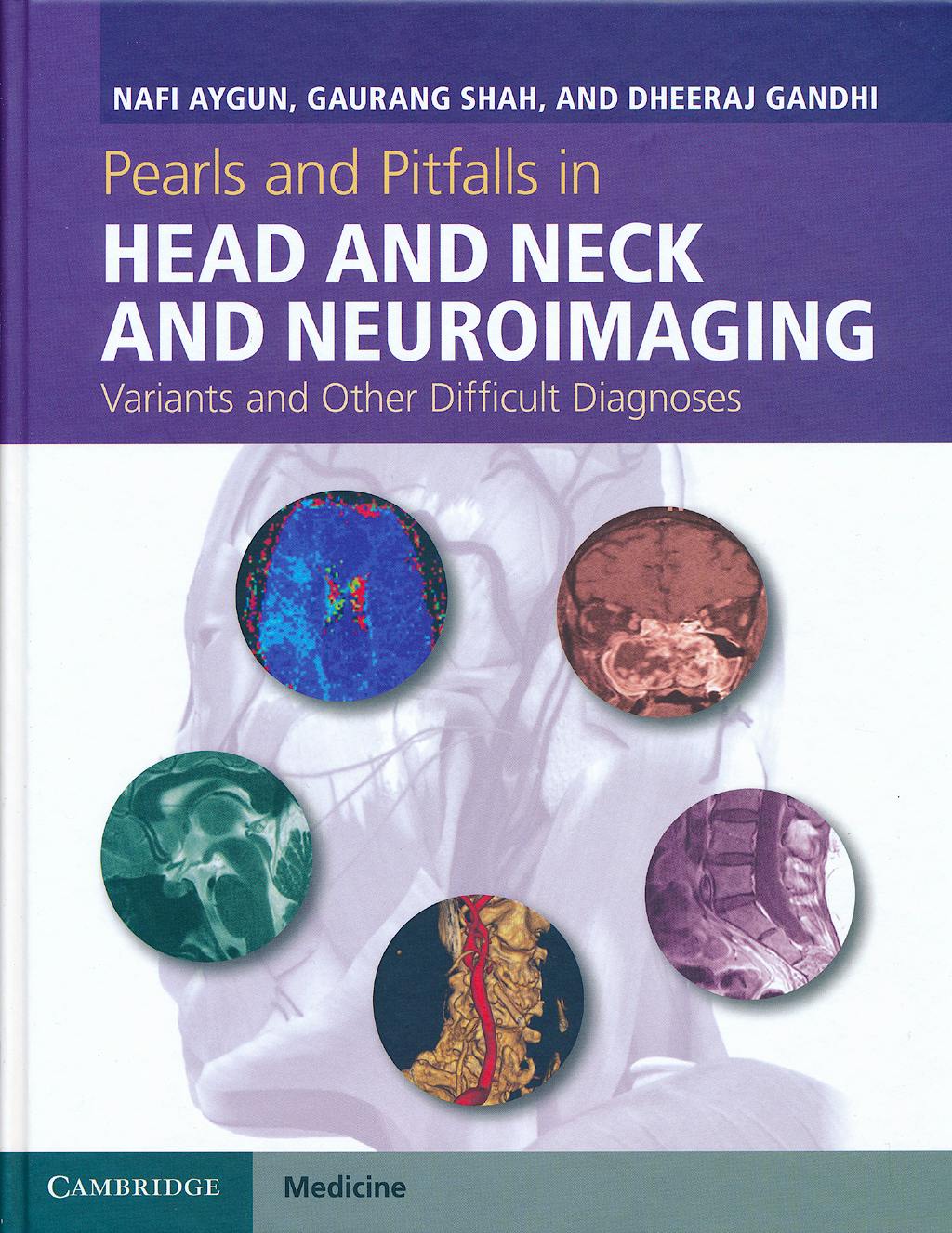 Portada del libro 9781107026643 Pearls and Pitfalls in Head and Neck and Neuroimaging. Variants and Other Difficult Diagnoses