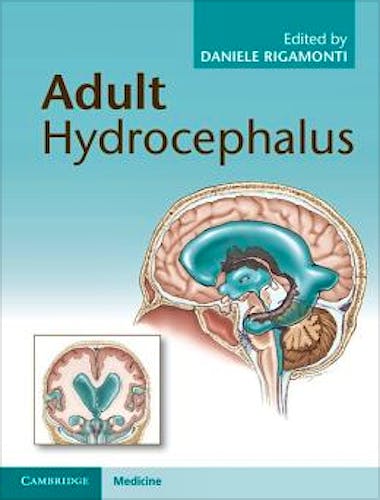 Portada del libro 9781107031777 Adult Hydrocephalus