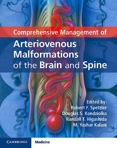 Portada del libro 9781107033887 Comprehensive Management of Arteriovenous Malformations of the Brain and Spine