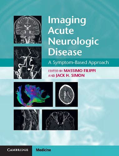 Portada del libro 9781107035942 Imaging Acute Neurologic Disease. a Symptom-Based Approach