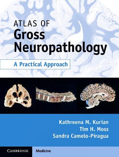 Portada del libro 9781107038165 Atlas of Gross Neuropathology. a Practical Approach (Online and Print)