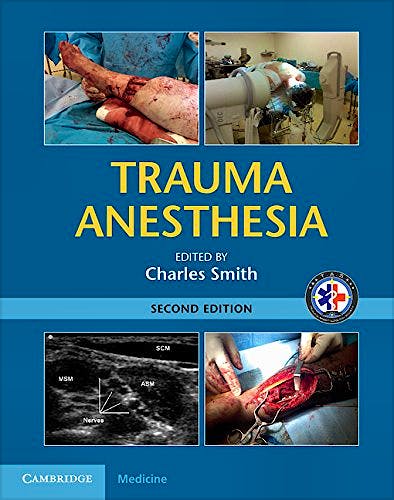 Portada del libro 9781107038264 Trauma Anesthesia