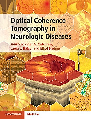 Portada del libro 9781107041301 Optical Coherence Tomography in Neurologic Diseases