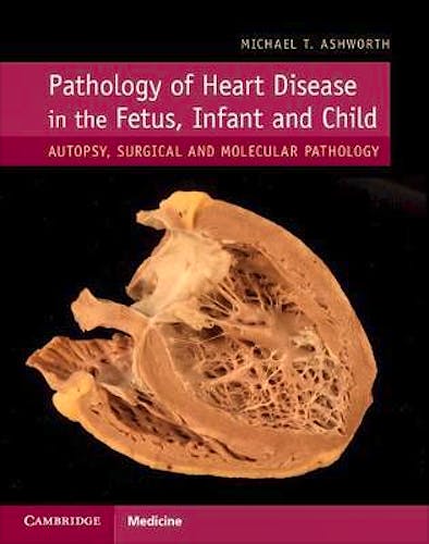 Portada del libro 9781107116283 Pathology of Heart Disease in the Fetus, Infant and Child. Autopsy, Surgical and Molecular Pathology
