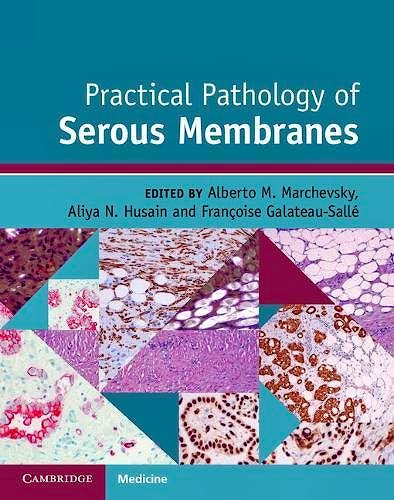 Portada del libro 9781107119642 Practical Pathology of Serous Membranes