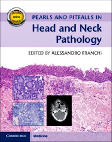 Portada del libro 9781107123496 Pearls and Pitfalls in Head and Neck Pathology