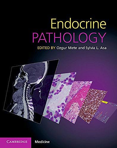 Portada del libro 9781107443310 Endocrine Pathology + Online Access