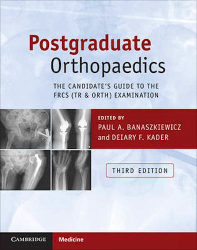 Portada del libro 9781107451643 Postgraduate Orthopaedics. The Candidate's Guide to the FRCS (TR and ORTH) Examination