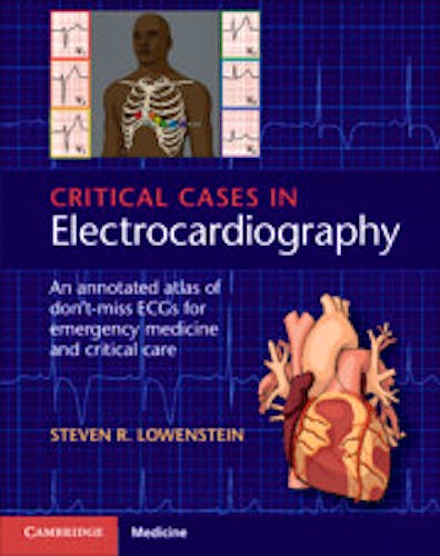 Portada del libro 9781107535916 Critical Cases in Electrocardiography. An Annotated Atlas of Don't-Miss ECGs for Emergency and Critical Care