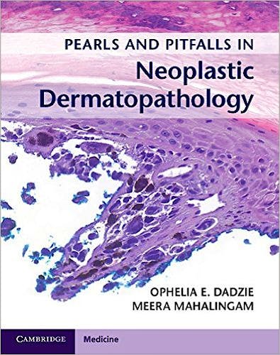 Portada del libro 9781107584587 Pearls and Pitfalls in Neoplastic Dermatopathology