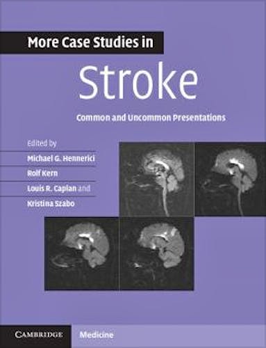 Portada del libro 9781107610033 More Case Studies in Stroke. Common and Uncommon Presentations