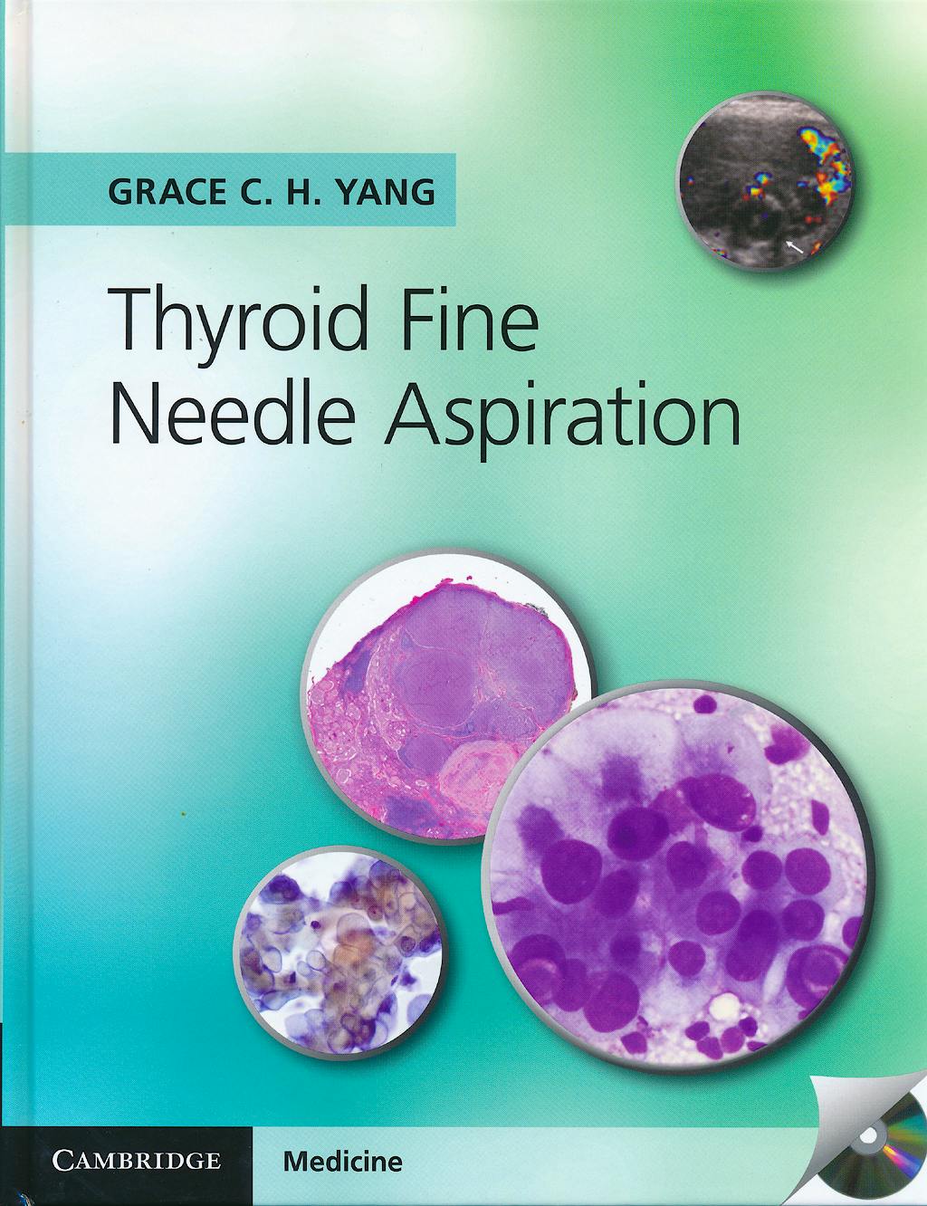 Portada del libro 9781107618138 Thyroid Fine Needle Aspiration