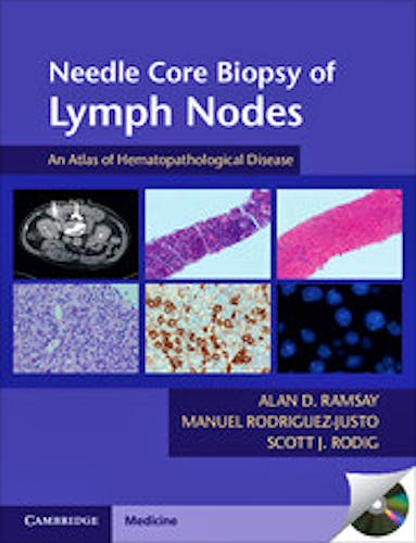 Portada del libro 9781107624542 Needle Core Biopsy of Lymph Nodes
