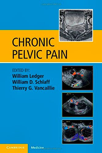 Portada del libro 9781107636620 Chronic Pelvic Pain